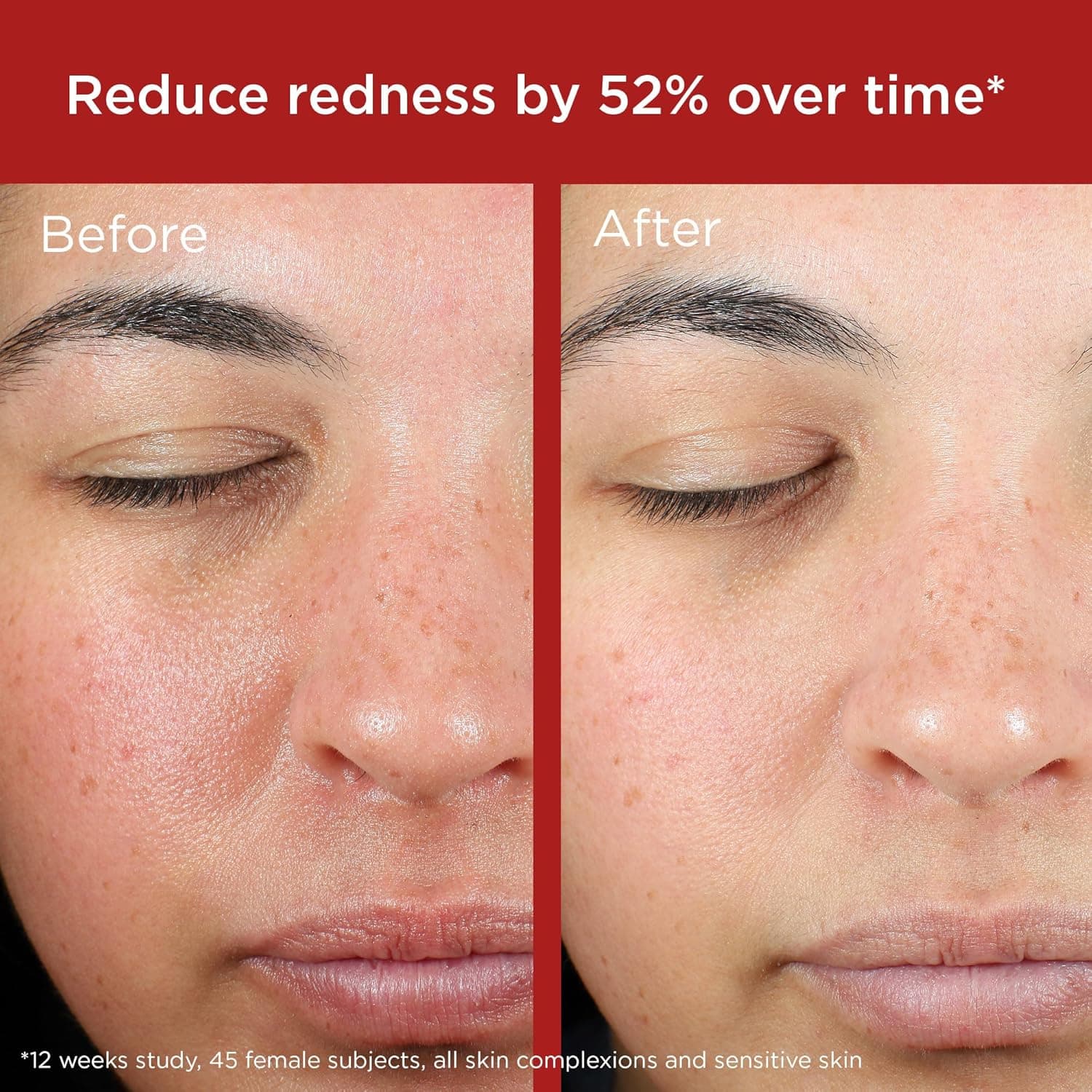 EltaMD UV Skin Recovery Face Sunscreen with Zinc Oxide – image 4
